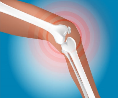 Beating Knee Pain: Strength & Mobility Steps